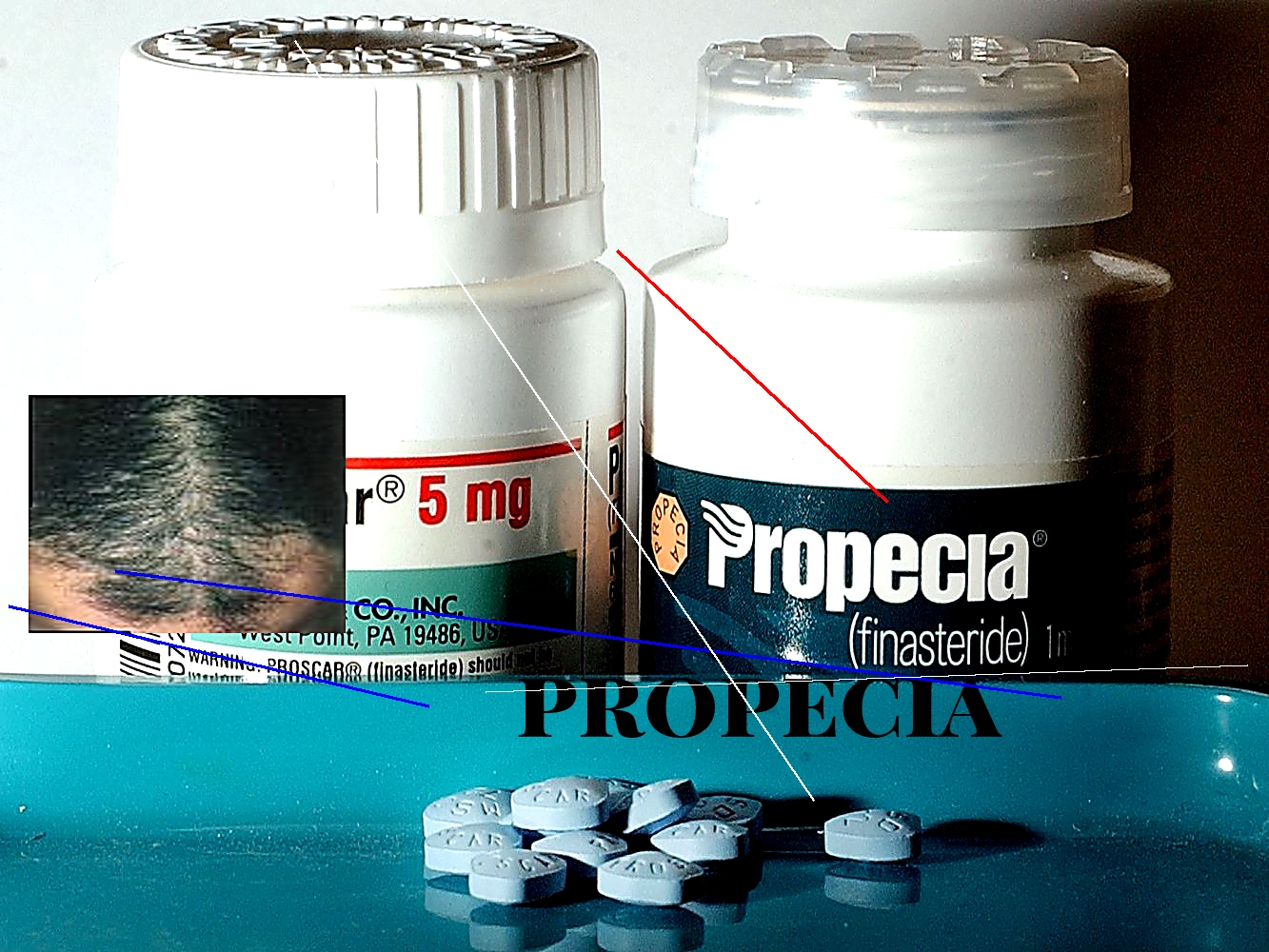 Pharmacie propecia